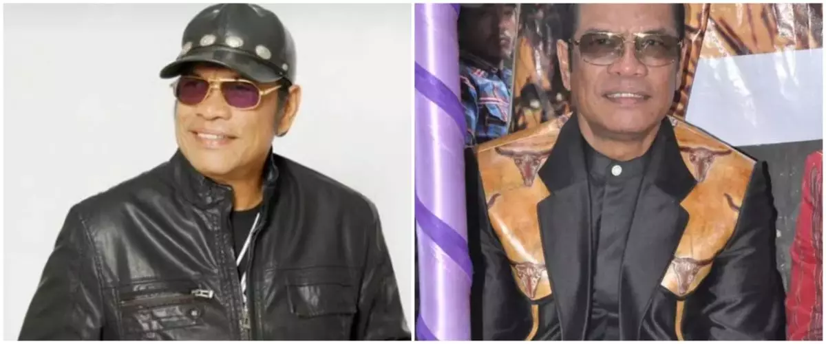 Sosok Jack Marpaung, penyanyi legendaris Batak yang meninggal di usia 76 tahun