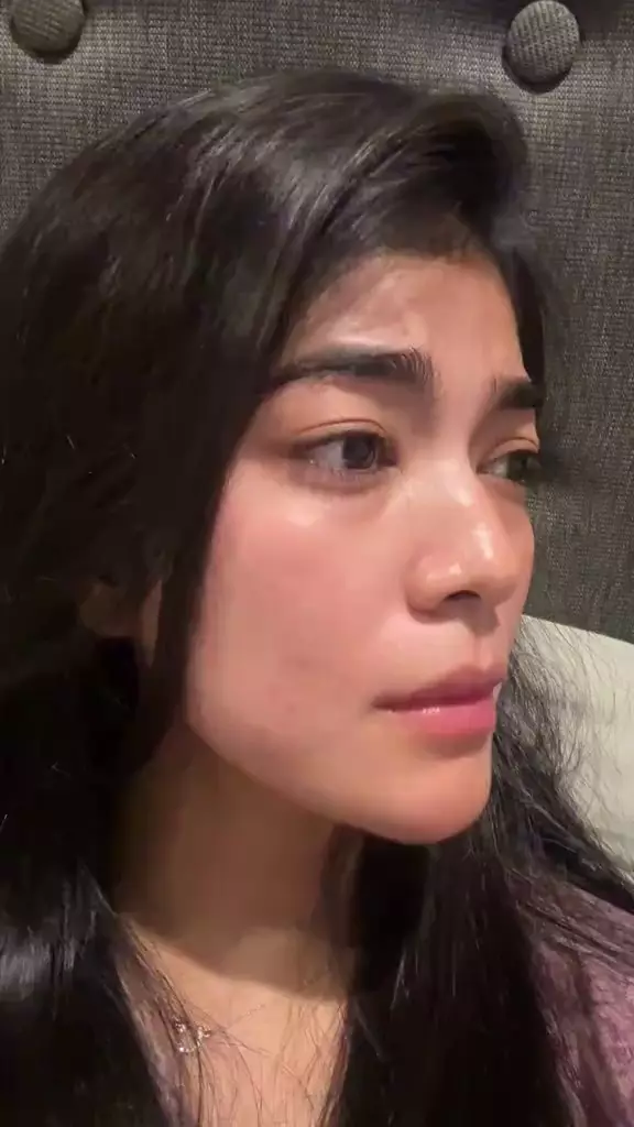 raya kohandi operasi plastik © 2025 TikTok