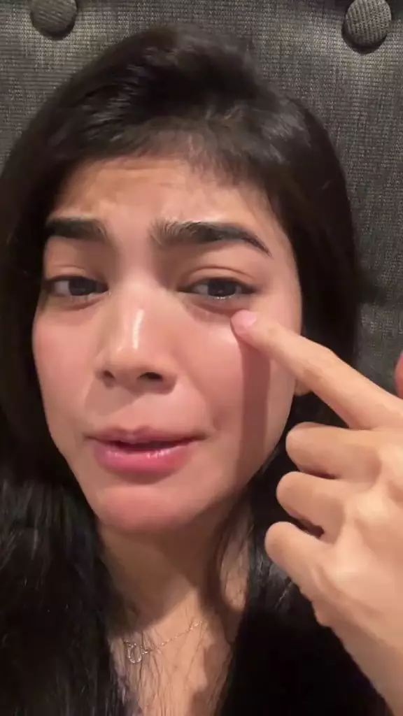 raya kohandi operasi plastik © 2025 TikTok