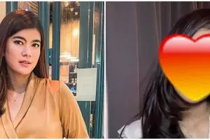 9 Potret Raya Kohandi usai operasi plastik di Korea Selatan, biking pangling sampai disebut beda orang