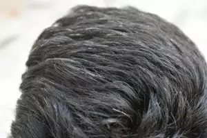 Tanpa urang-aring, begini trik mengubah uban jadi rambut hitam lebat lagi pakai 1 jenis daun