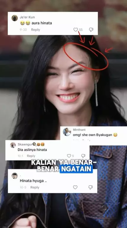 Nita Gunawan jalani transfer lemak © TikTok Nita Gunawan jalani transfer lemak © TikTok