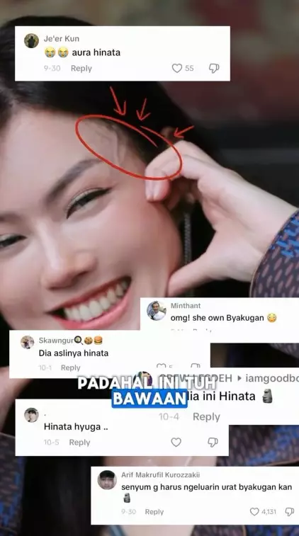 Nita Gunawan jalani transfer lemak © TikTok Nita Gunawan jalani transfer lemak © TikTok
