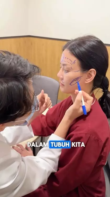 Nita Gunawan jalani transfer lemak © TikTok Nita Gunawan jalani transfer lemak © TikTok