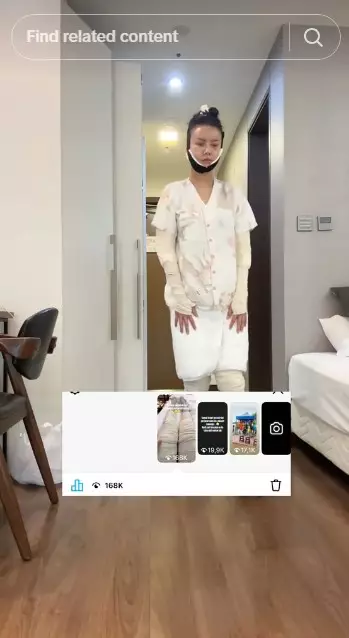 Nita Gunawan jalani transfer lemak © TikTok Nita Gunawan jalani transfer lemak © TikTok