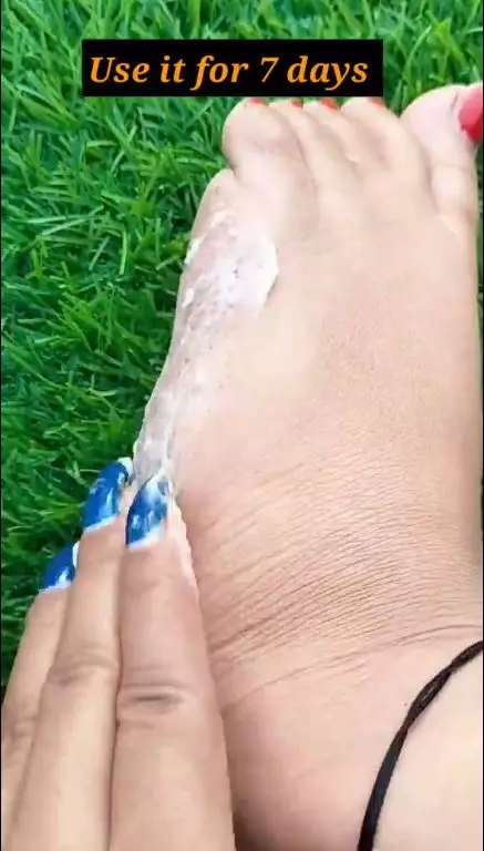 cara simpel muluskan tumit kaki retak berbagai sumber