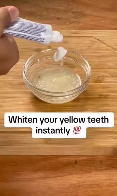 Bawang putih hilangkan noda kuning pada gigi Berbagai sumber Bawang putih hilangkan noda kuning pada gigi Berbagai sumber