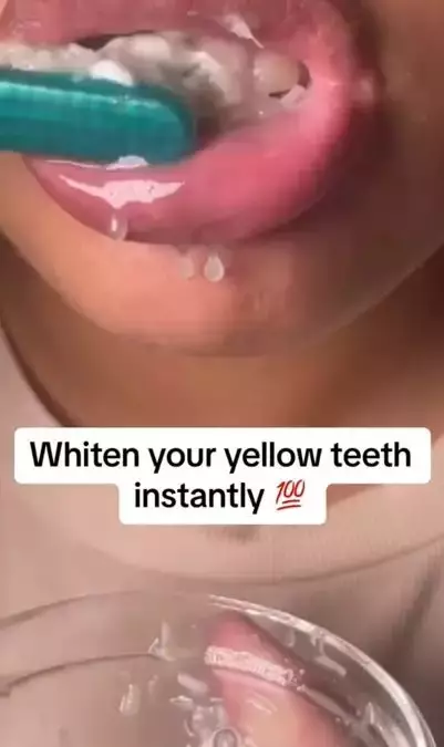 Bawang putih hilangkan noda kuning pada gigi Berbagai sumber Bawang putih hilangkan noda kuning pada gigi Berbagai sumber