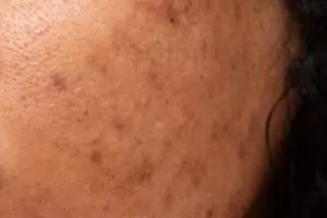 Cara memudarkan kerutan dan garis halus di wajah pakai 1 jenis umbi-umbian, auto mulus seketika