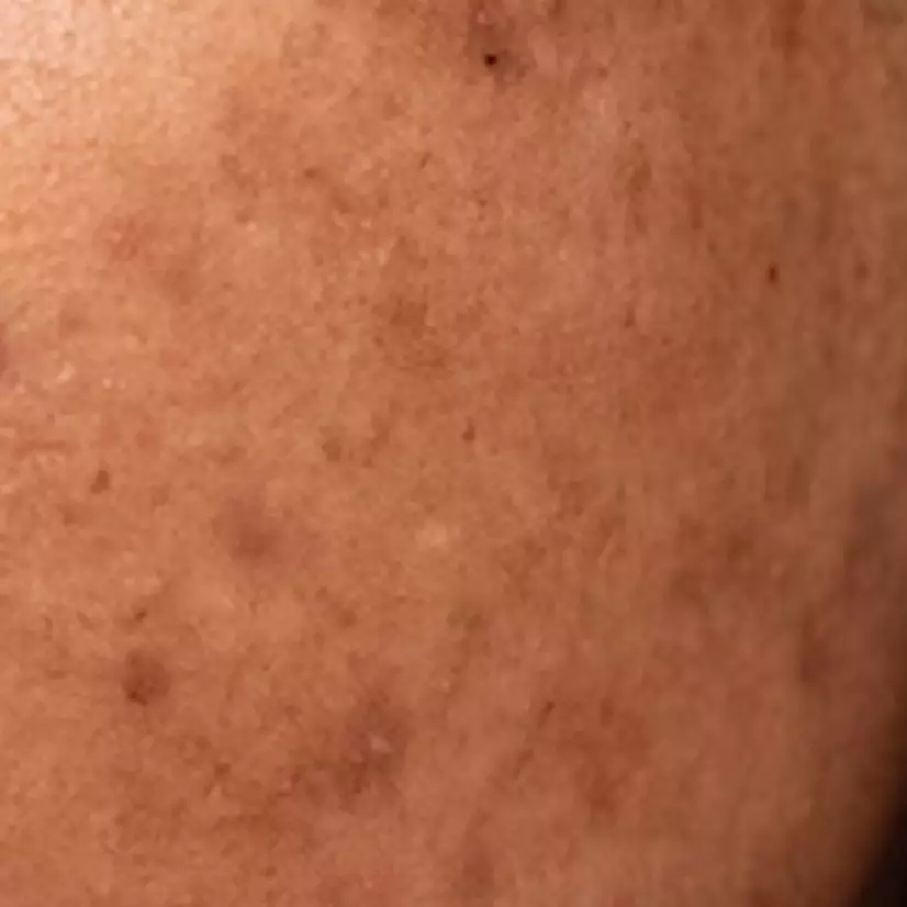 Cara memudarkan kerutan dan garis halus di wajah pakai 1 jenis umbi-umbian, auto mulus seketika