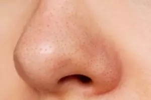 Cara bikin pori wajah mengecil dan bersih optimal dengan 1 jenis rempah, glowing dalam seminggu