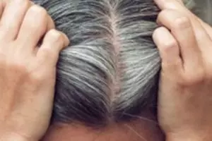 Cara bikin uban kembali hitam cuma pakai 1 jenis minyak, hasilnya terlihat dalam seminggu