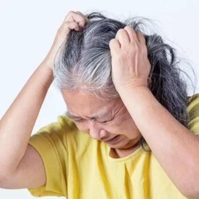 Bukan pakai semir rambut, ternyata begini cara cegah uban prematur pakai 1 bumbu dapur