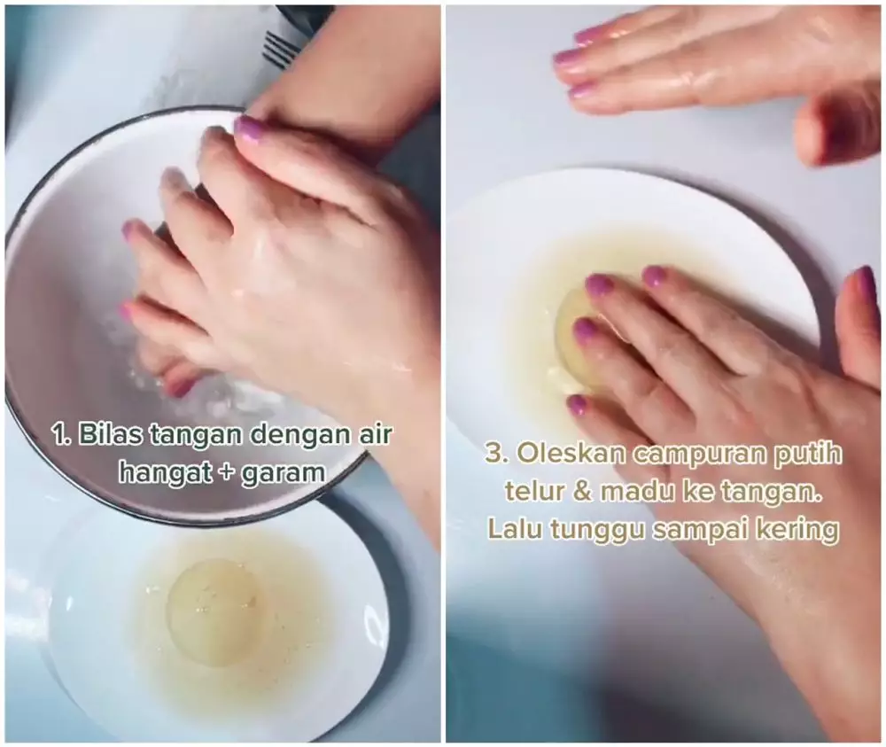 Cara menghilangkan keriput di tangan © TikTok