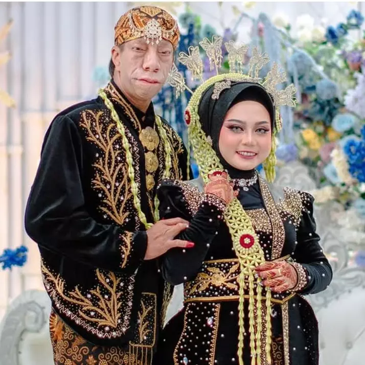 Ingat Surya Manurung pengidap sindrom langka? Kini gelar pesta nikah selang 2 tahun akad, 9 potretnya