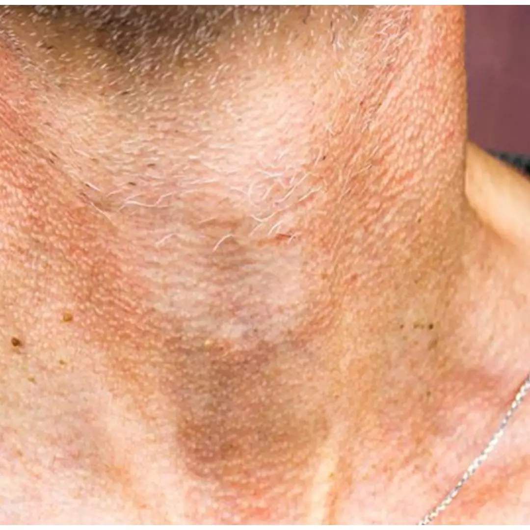 Jadi mulus tanpa lipatan, begini cara mencerahkan leher dekil pakai tambahan 1 bahan minuman