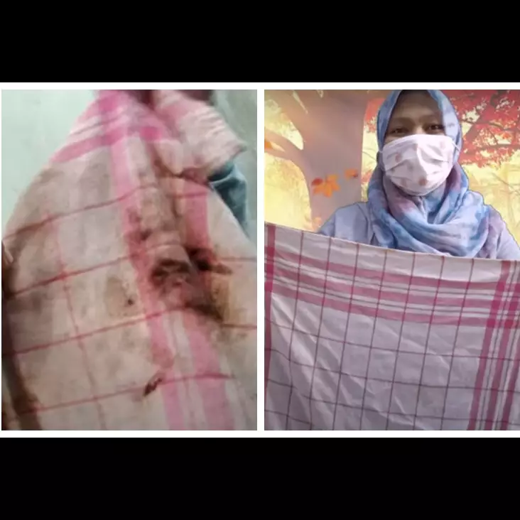 Cara cepat bersihkan kain serbet dapur kumal dekil kotor pakai 1 bahan dapur, cuma modal Rp 1.000