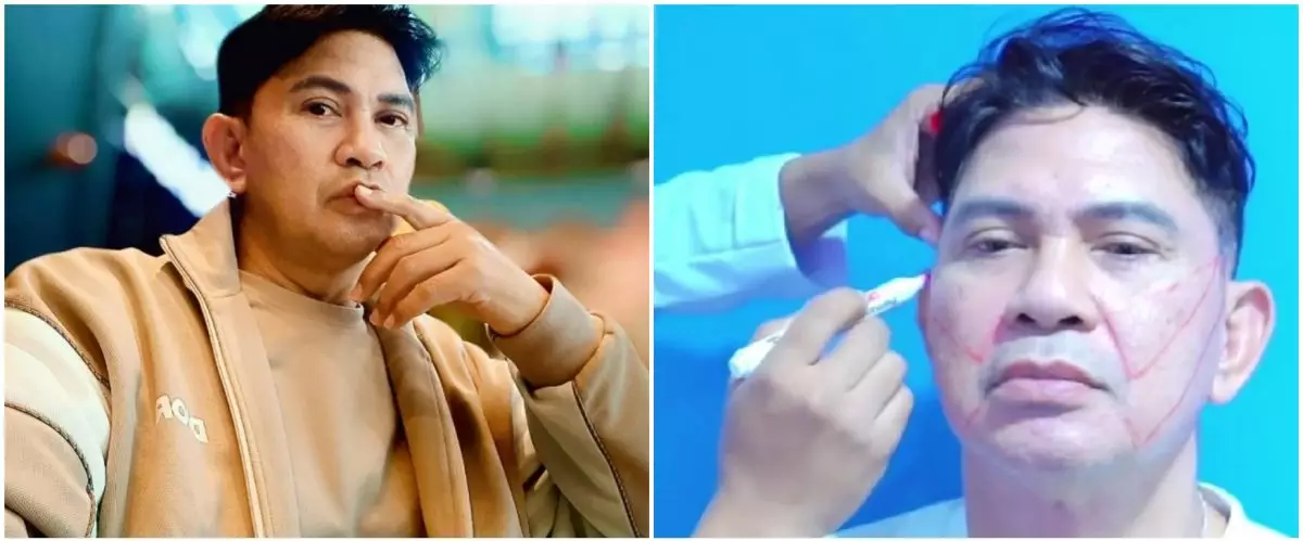 9 Momen Ronny Sianturi jalani oplas agar tampak awet muda, jadi kado diri sendiri di usia 60 tahun