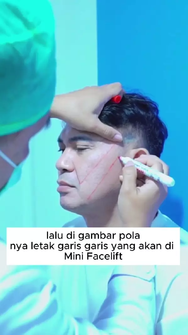 Momen Ronnie Sianturi jalani oplas © Instagram Momen Ronnie Sianturi jalani oplas © Instagram