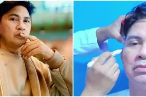 9 Momen Ronny Sianturi jalani oplas agar tampak awet muda, jadi kado diri sendiri di usia 60 tahun