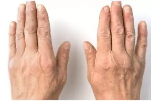 Kulit langsung mulus, begini trik pudarkan keriput di punggung tangan pakai masker dari 1 jenis buah