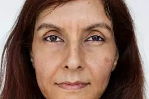 Cara cerahkan flek hitam di wajah akibat sinar matahari pakai 1 jenis daun, bukan pakai masker kunyit