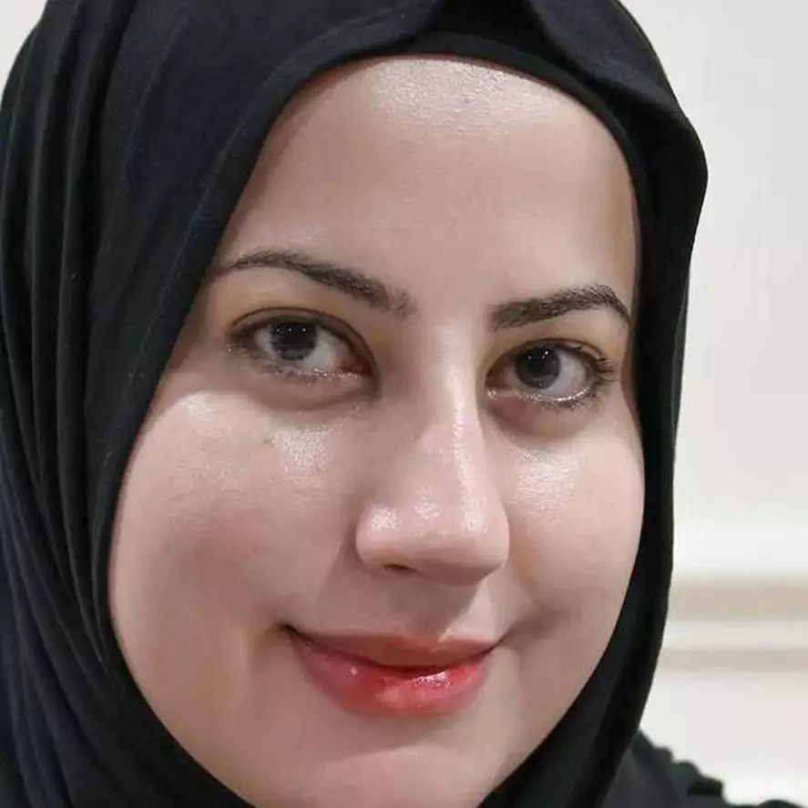 Pernah punya wajah bopeng, ini cara Tasyi Athasyia bikin kulit mulus lagi cuma dalam 1 bulan