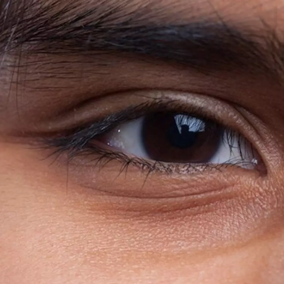 Cara mudah dan alami menghilangkan mata panda ini bantu samarkan garis halus meski tanpa eye cream