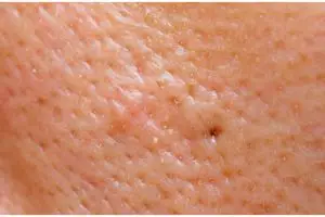 Cara bikin pori-pori mengecil agar kulit tampak mulus cuma pakai 1 kulit buah, nggak perlu pakai kopi