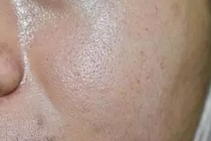 Trik bikin toner rapatkan pori-pori kulit berminyak dengan 1 jenis sayuran, bukan diusap pakai es