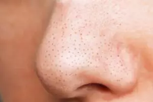 Cara menghaluskan tekstur kulit akibat pori-pori besar pakai 1 jenis lalapan, bukan pakai garam