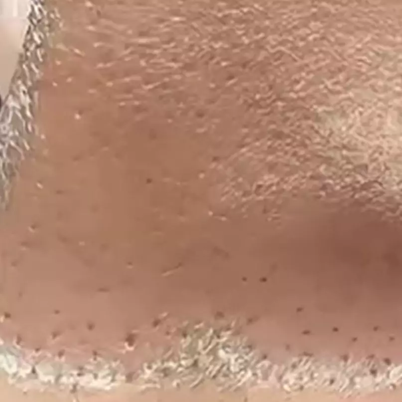 Cara bersihkan pori-pori tersumbat penyebab komedo pakai 1 jenis tepung, tanpa lemon dan kopi 