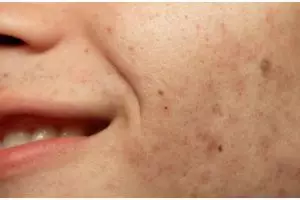 Cara kencangkan wajah kendur pakai spray dari 1 jenis sayuran, tak perlu beli masker kolagen