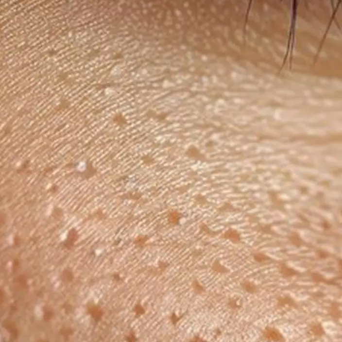 Cara kecilkan ukuran pori-pori wajah pakai 1 jenis bahan pemanis, bukan dengan scrub kopi