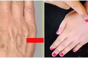 Kulit tangan tampak tua karena keriput dan kering? Ini cara mengatasinya cuma dengan 1 bahan minuman