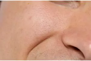 Kulit auto mulus, cara mengecilkan pori-pori besar ini bikin wajah bersih bebas kotoran dan minyak