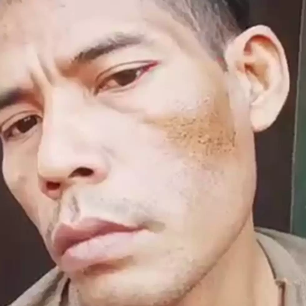 Hasil langsung terlihat, begini cara alami menghilangkan flek hitam cuma dengan 1 ampas dapur