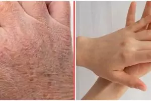 Tanpa lotion atau hand cream, ini trik kencangkan kulit tangan keriput dan kerutan agar mulus lagi