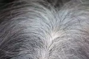 Cara mencegah uban di usia muda hanya pakai hair oil dari 1 jenis tanaman, tanpa minyak kelapa