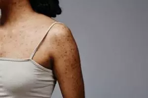 Cara rontokkan daki badan tanpa sisa pakai 1 jenis ampas minuman, bisa sekalian jaga lingkungan