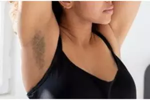 Trik cerahkan ketiak berdaki pakai 1 jenis tepung, bukan pakai kunyit maupun kopi