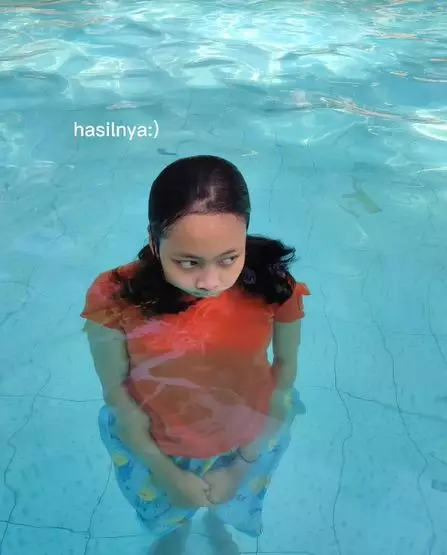 hasil foto gagal estetik © TikTok/@lhohehkok