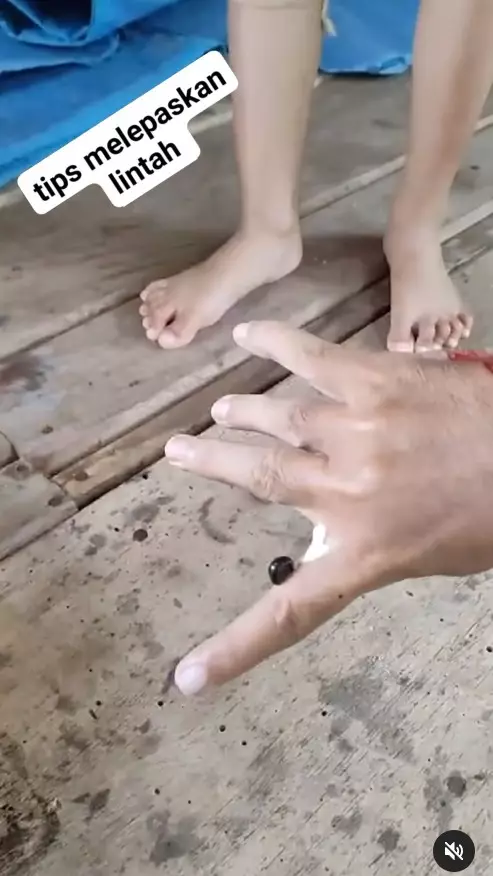 trik efektif melepas gigitan lintah © Instagram