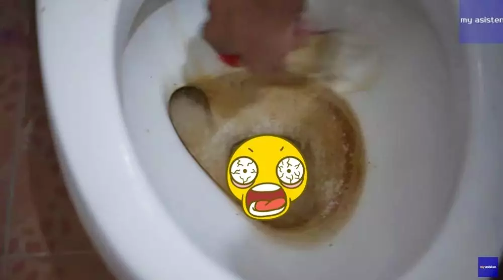 trik cepat bersihkan kerak membandel di kloset pakai cuka apel  © YouTube