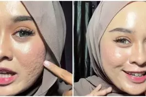 Bukan diset bedak padat, ini trik mengatasi makeup bertekstur agar lebih blurring pada wajah bopeng