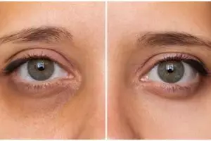 Tak perlu repot pakai eye mask, begini cara atasi mata panda secara alami pakai 1 bahan minuman