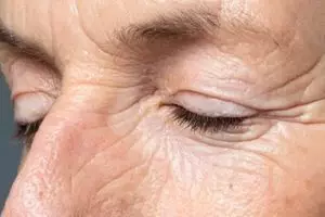 Cara pudarkan keriput pada wajah mengendur pakai 1 bubuk minuman, nggak usah beli minuman kolagen