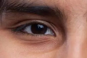 Cara memutihkan kulit area bawah mata dengan 3 bahan dapur, bukan pakai tambahan kopi