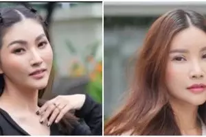 Potret wajah 25 seleb sebelum dan sesudah operasi plastik, perubahannya bak beda orang