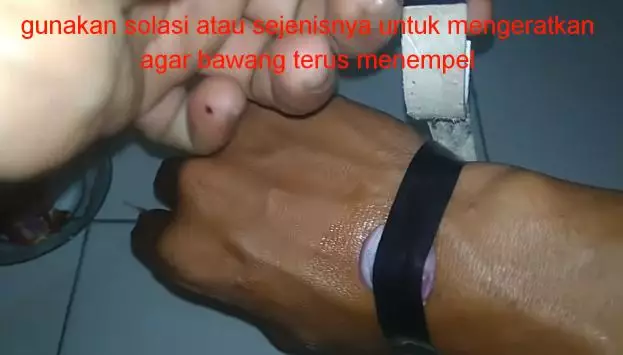 cara mengeluarkan duri pakai bawang merah © 2023 brilio.net